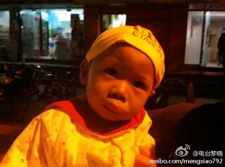 4跟进约3个月后，可爱的小甜甜终于手术成功了！